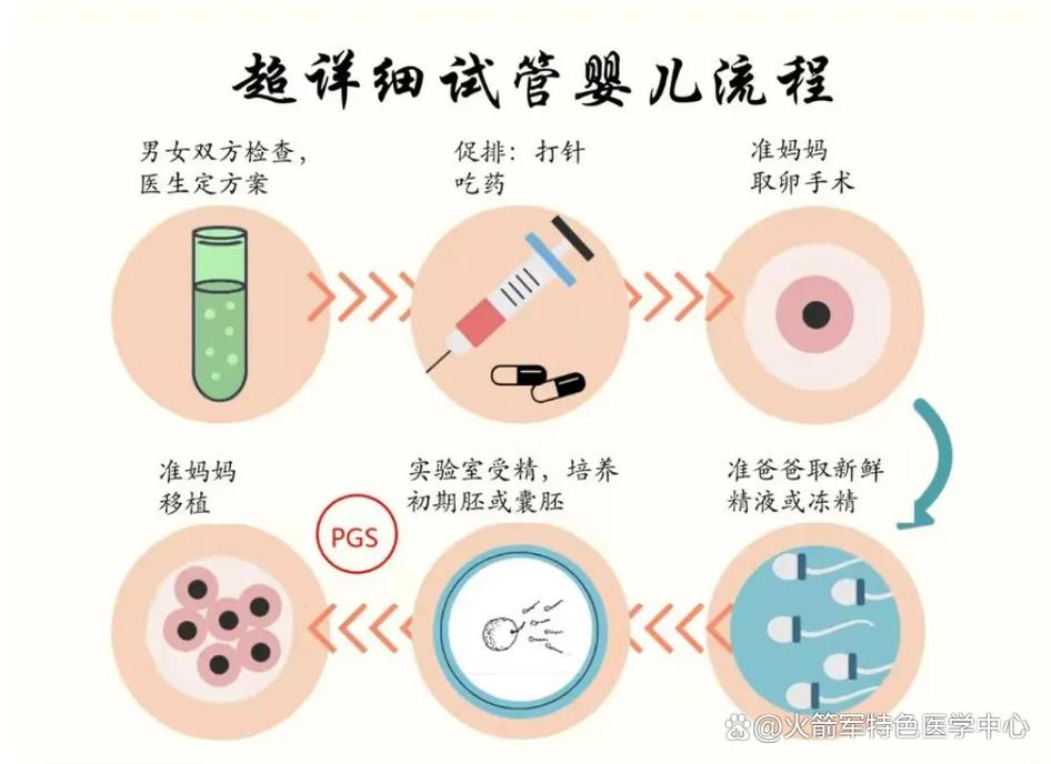试管婴儿逆转不孕困境：如何实现？