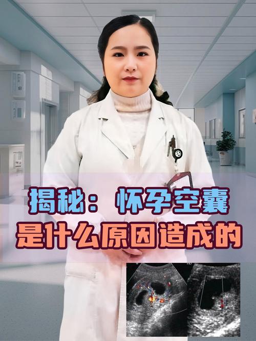 卵黄囊空