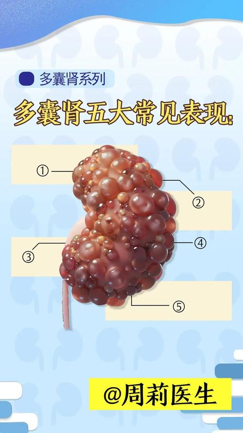 多囊肾患者能否通过试管婴儿技术成功怀孕？