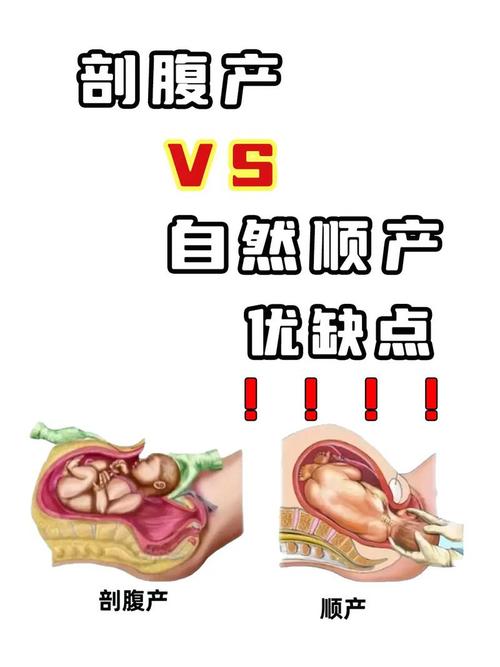 试管婴儿的诞生：靠谱吗？都是顺产吗？