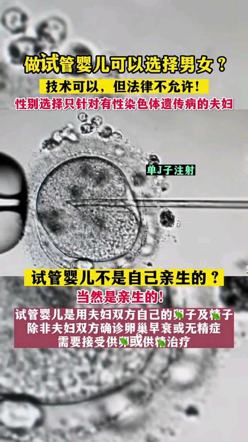 揭秘：哪家医院试管婴儿可以选择性别？