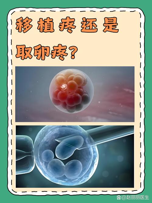 试管婴儿的取卵与移植：哪个环节最痛苦？