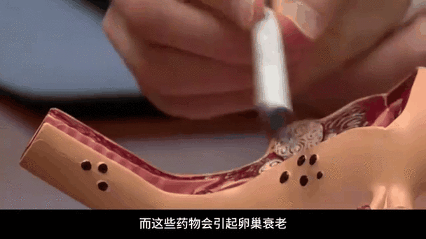 做试管婴儿后，你会感到疼吗？