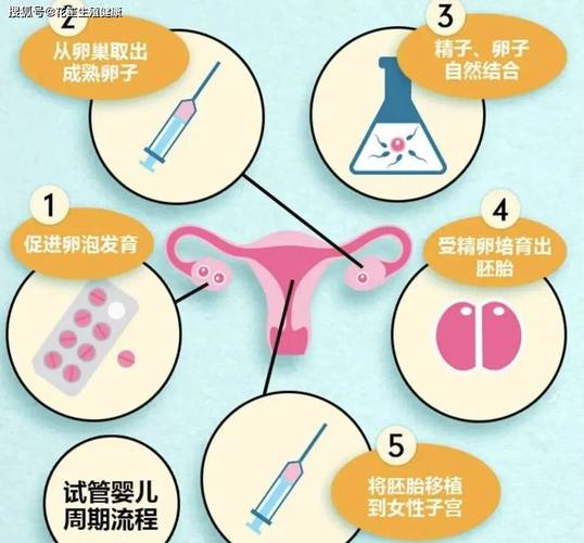 输卵管手术如何助力试管婴儿成功率提升？