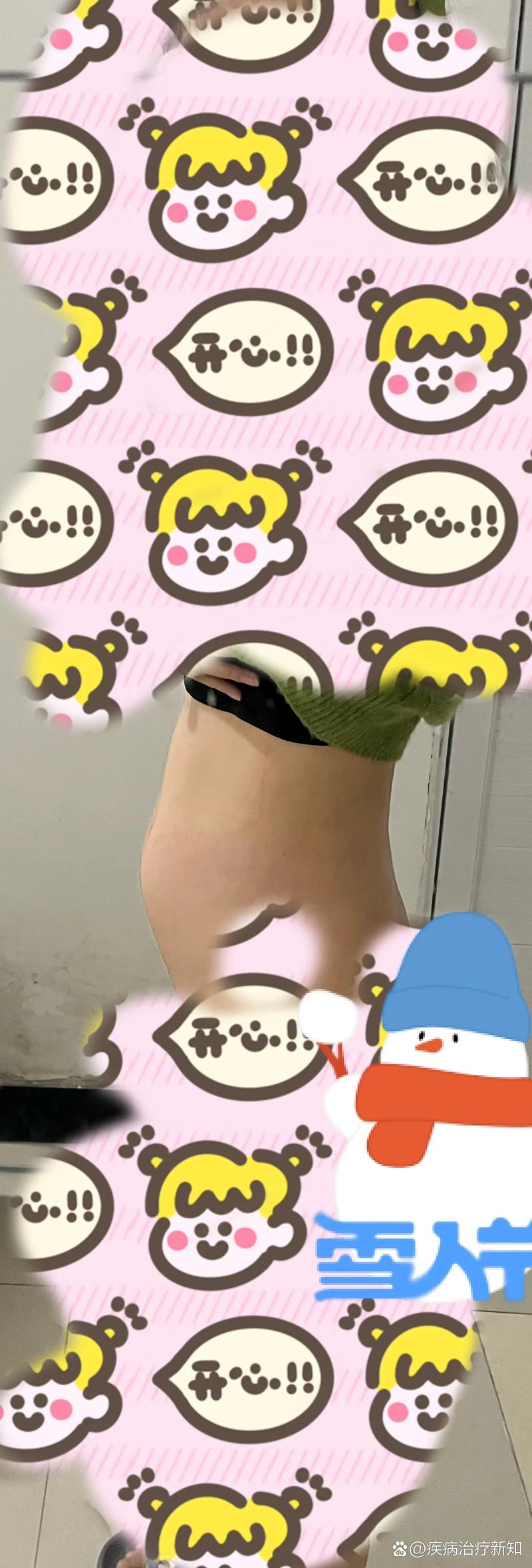 小腹微凸可能是你孕育的开始吗？