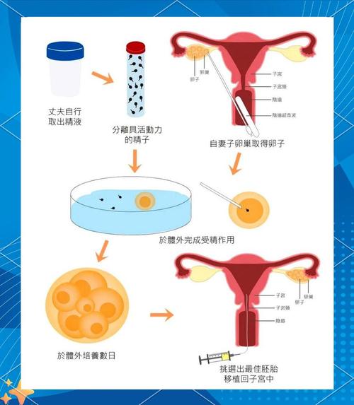 试管婴儿技术如何帮助父母选择宝宝性别？