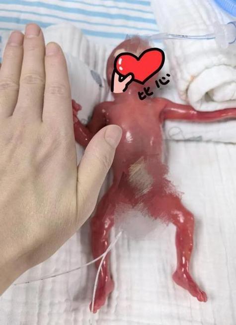 试管婴儿在妈妈肚子里发生什么奇迹？