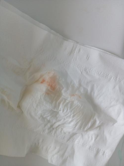 试管婴儿九周仍有出血情况不得不问医生？