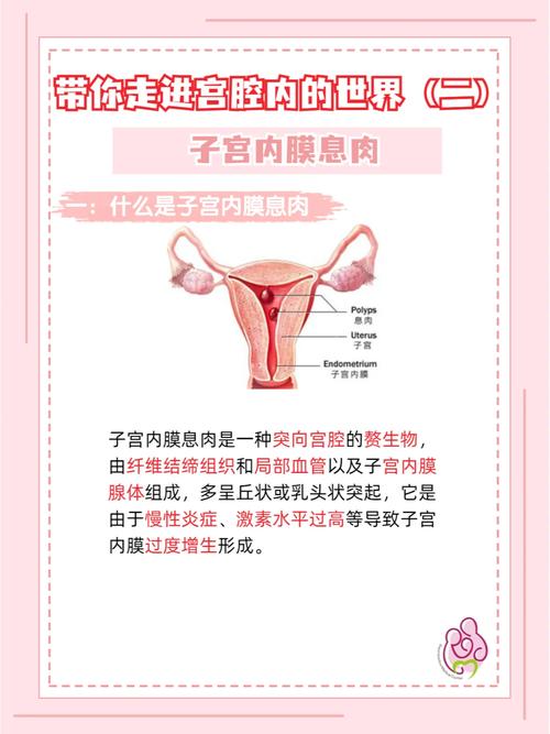 试管婴儿手术后如何预防子宫息肉？