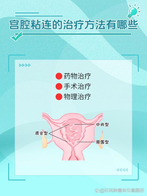 宫腔粘连患者如何成功实施试管婴儿疗法？