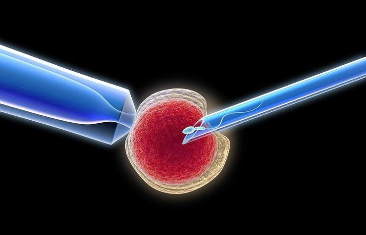 试管婴儿的起源与发展：哪个国家最早发明？