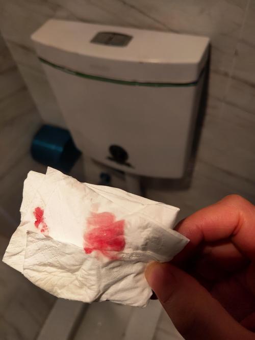 试管婴儿过程中的出血现象是常见吗？