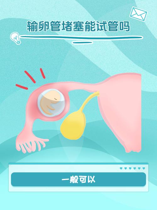 输卵管堵塞如何通过试管婴儿实现生育夢想？